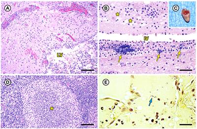 Pathology, microbiology, and genetic diversity associated with Erysipelothrix rhusiopathiae and novel Erysipelothrix spp. infections in southern <mark class="highlighted">sea otters</mark> (Enhydra lutris nereis)